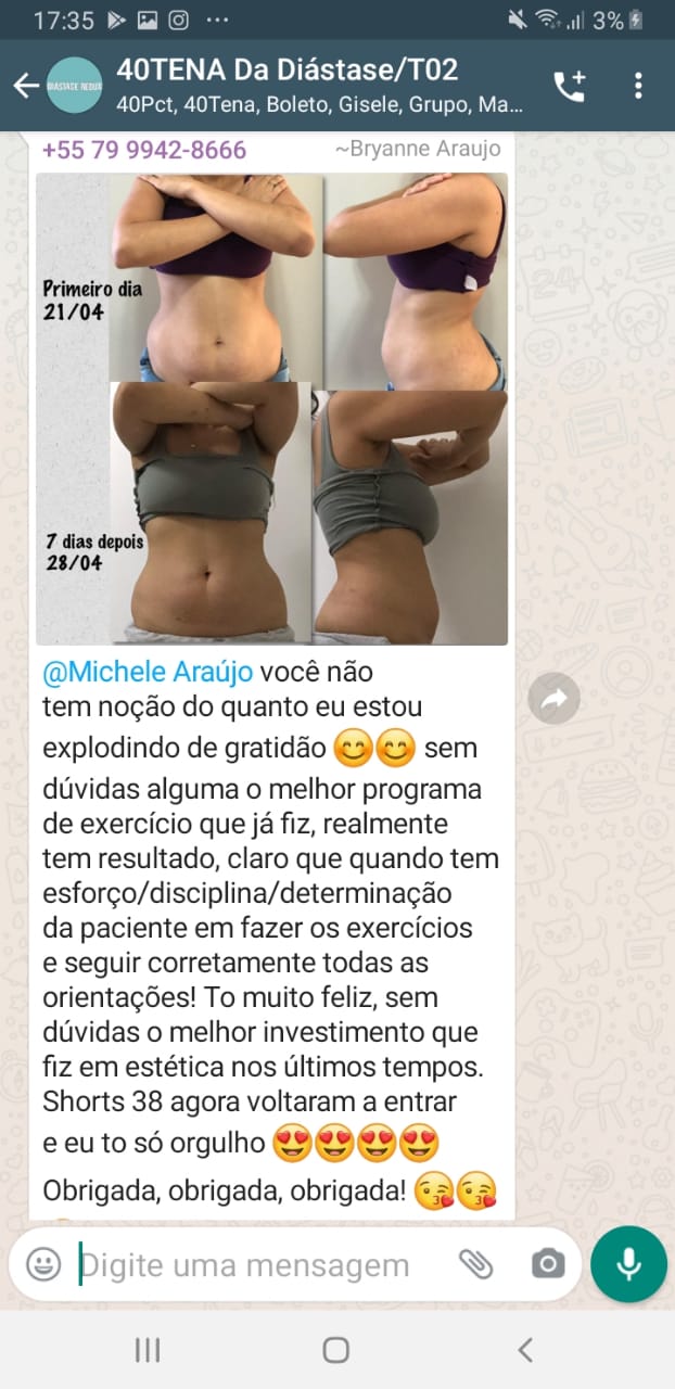 Diastase Rascunho Gatilho Digital